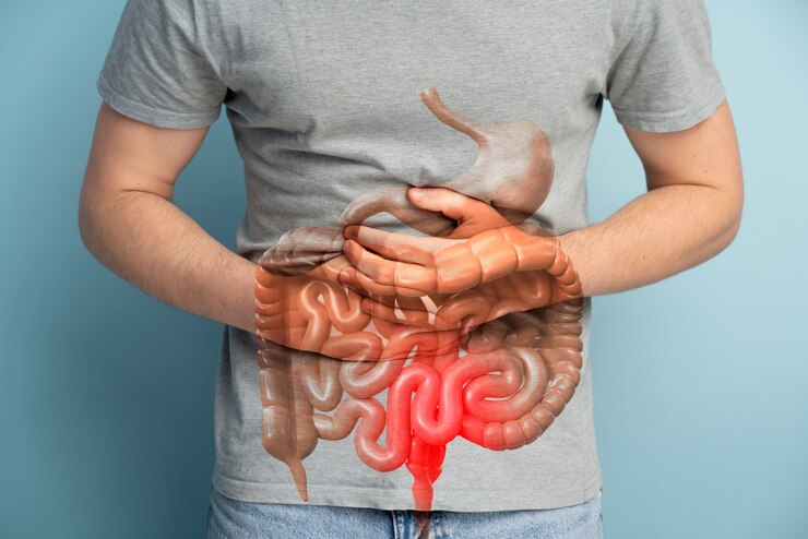 viêm đại tràng mãn tính có những biến chứng gì